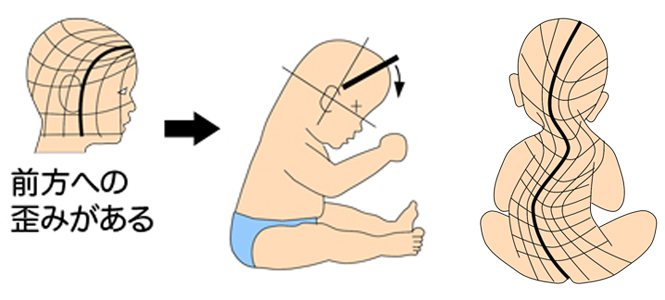 お座りできない 頭の形との関係は 中心軸赤ちゃん整体