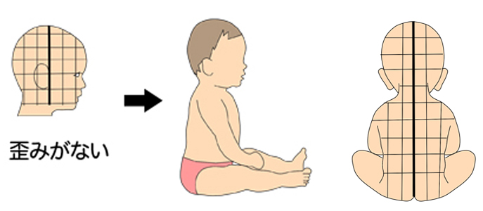 お座りできない 頭の形との関係は 中心軸赤ちゃん整体