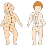 協調性発達運動障害