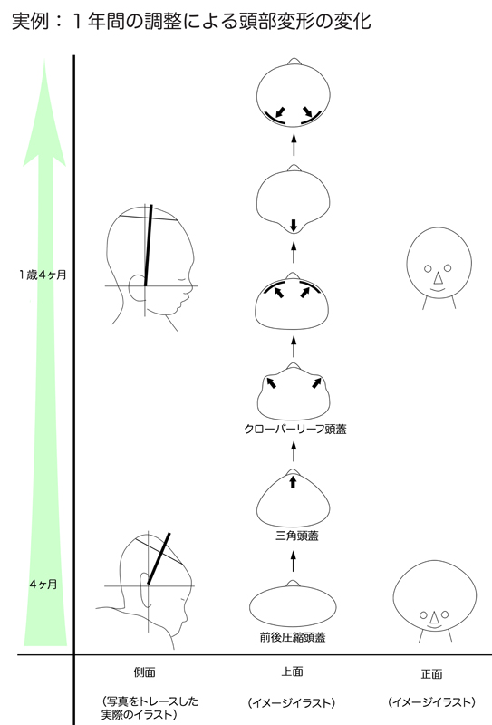 心 ツライを共有したい Sabetugaishine Twitter